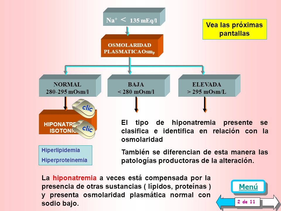 diabetes tipo 1 hiponatremia